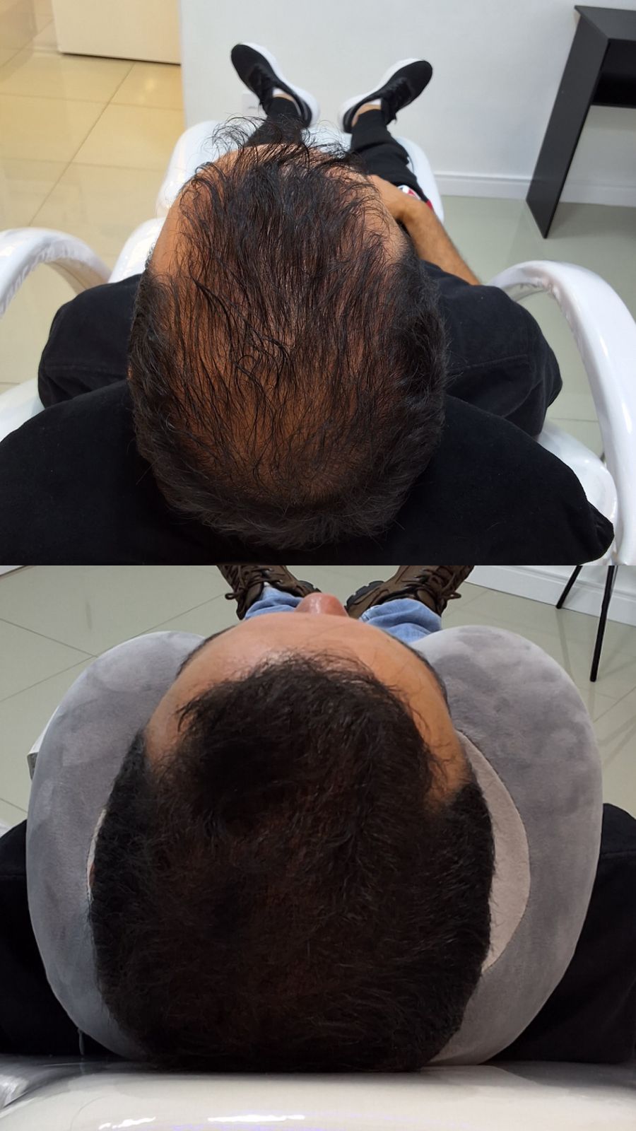 Registro complementar de evolução capilar autorizado